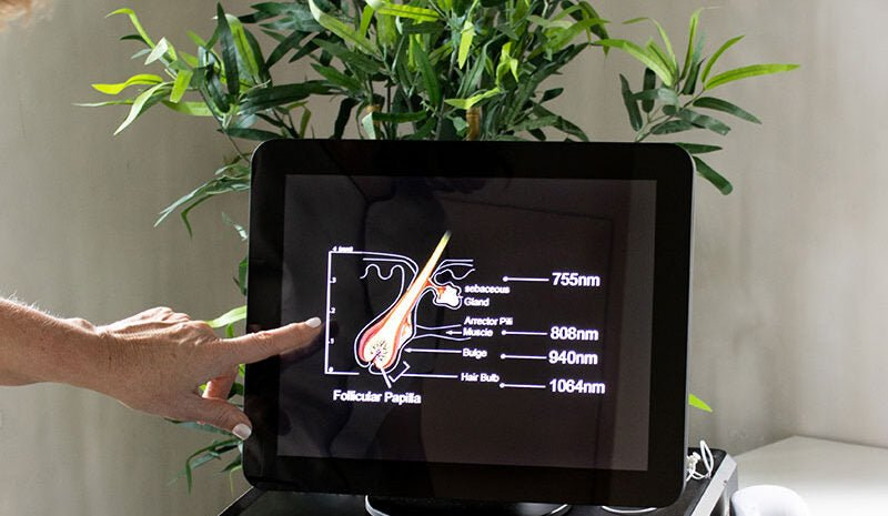Laser toestel afbeelding 1 (plaats jouw URL)