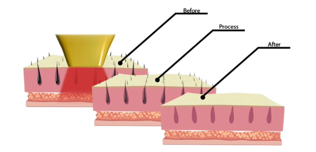 Huiddiagram / Before-Process-After (plaats jouw URL)